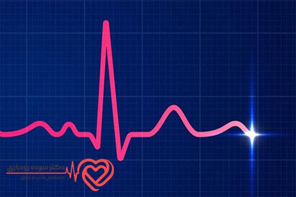 مزایای کاربرد نوار قلب یا EKG